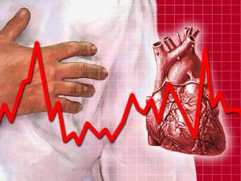 Nhịp tim không đều là triệu chứng bệnh tim mạch
